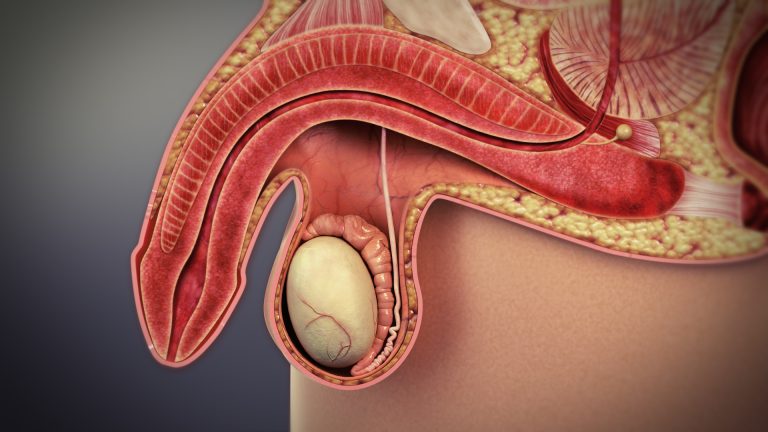Erectile_dysfunction