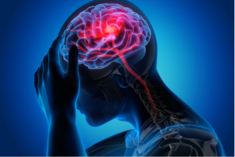 céphalées, mots de têtes et migraines