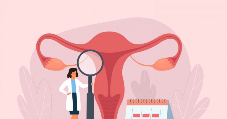 fibrome-uterin-choses-a-savoir