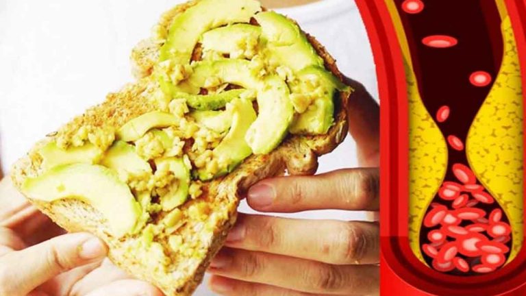 hypercholesterolemie-comment-la-faire-baisser