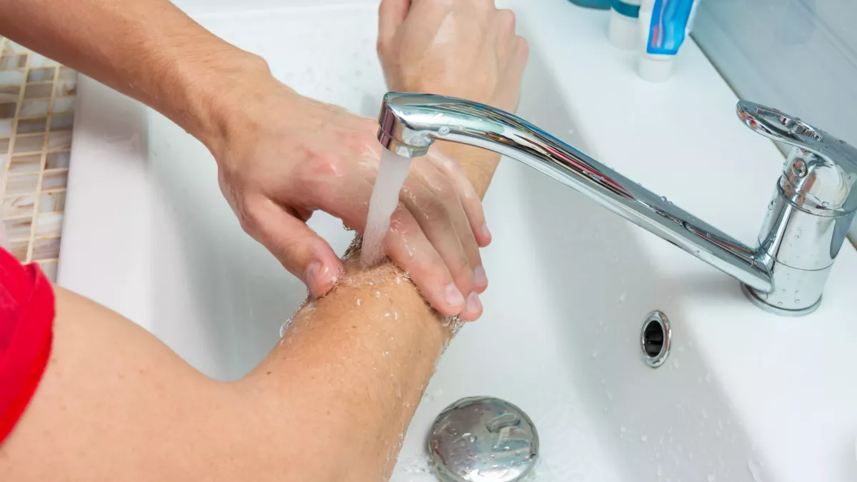 Est-ce conseillé de verser de l’eau fraiche sur une brûlure?