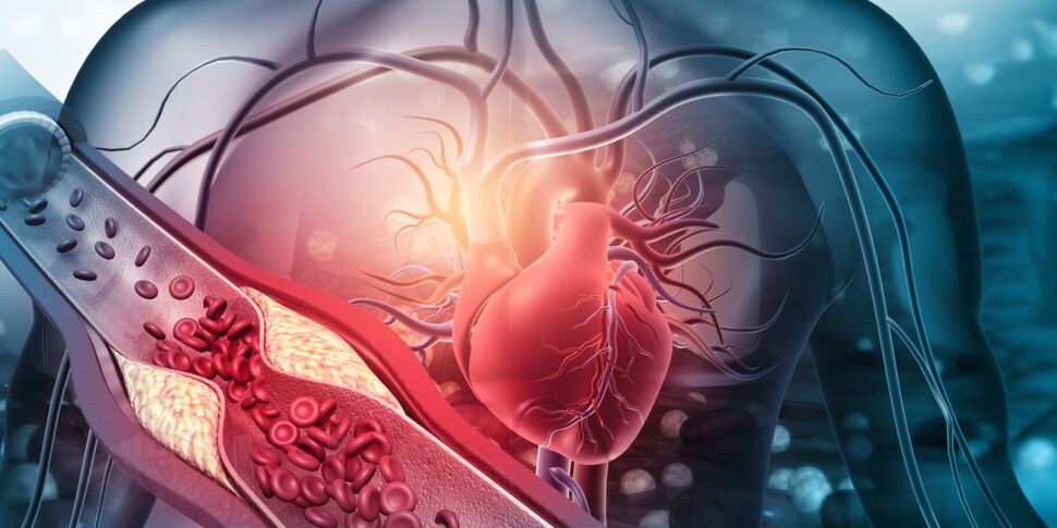 Maladie coronarienne: le mal qui tue 14 personnes par minute