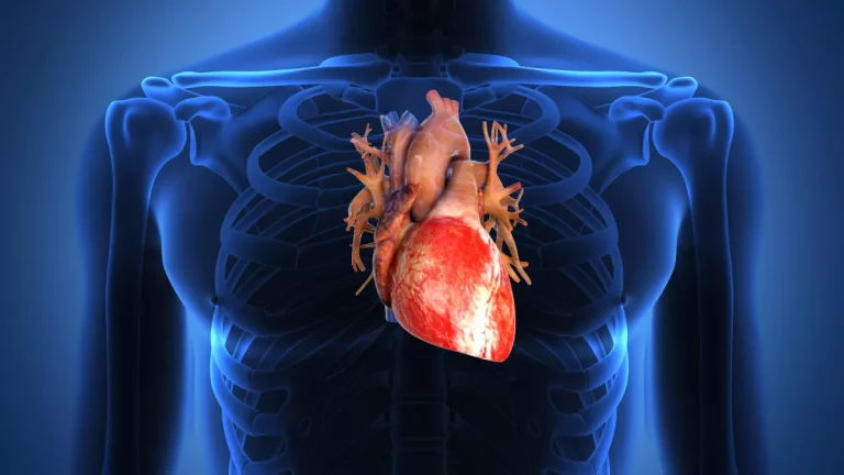 i104876-insuffisance-cardiaque-pm