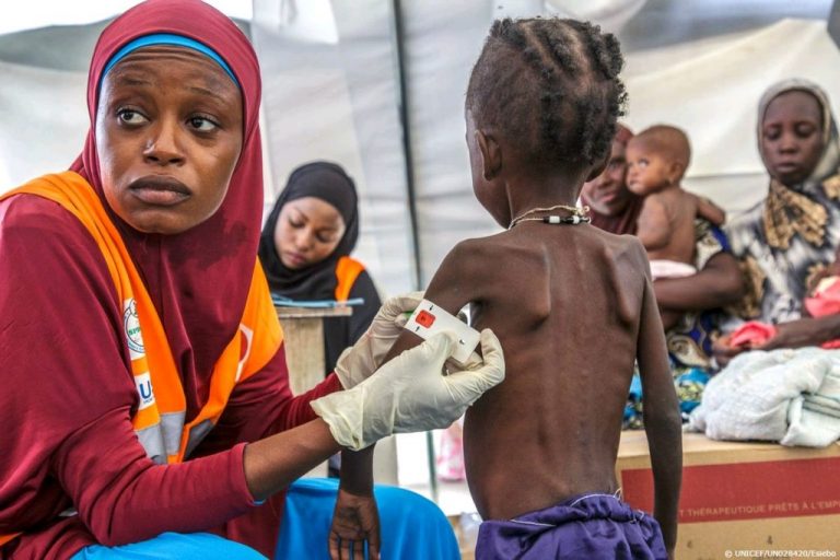 Severe-Acute-Malnutrition-of-nigeria-1024×683