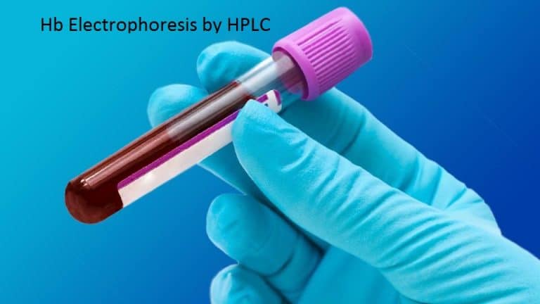 hplc1