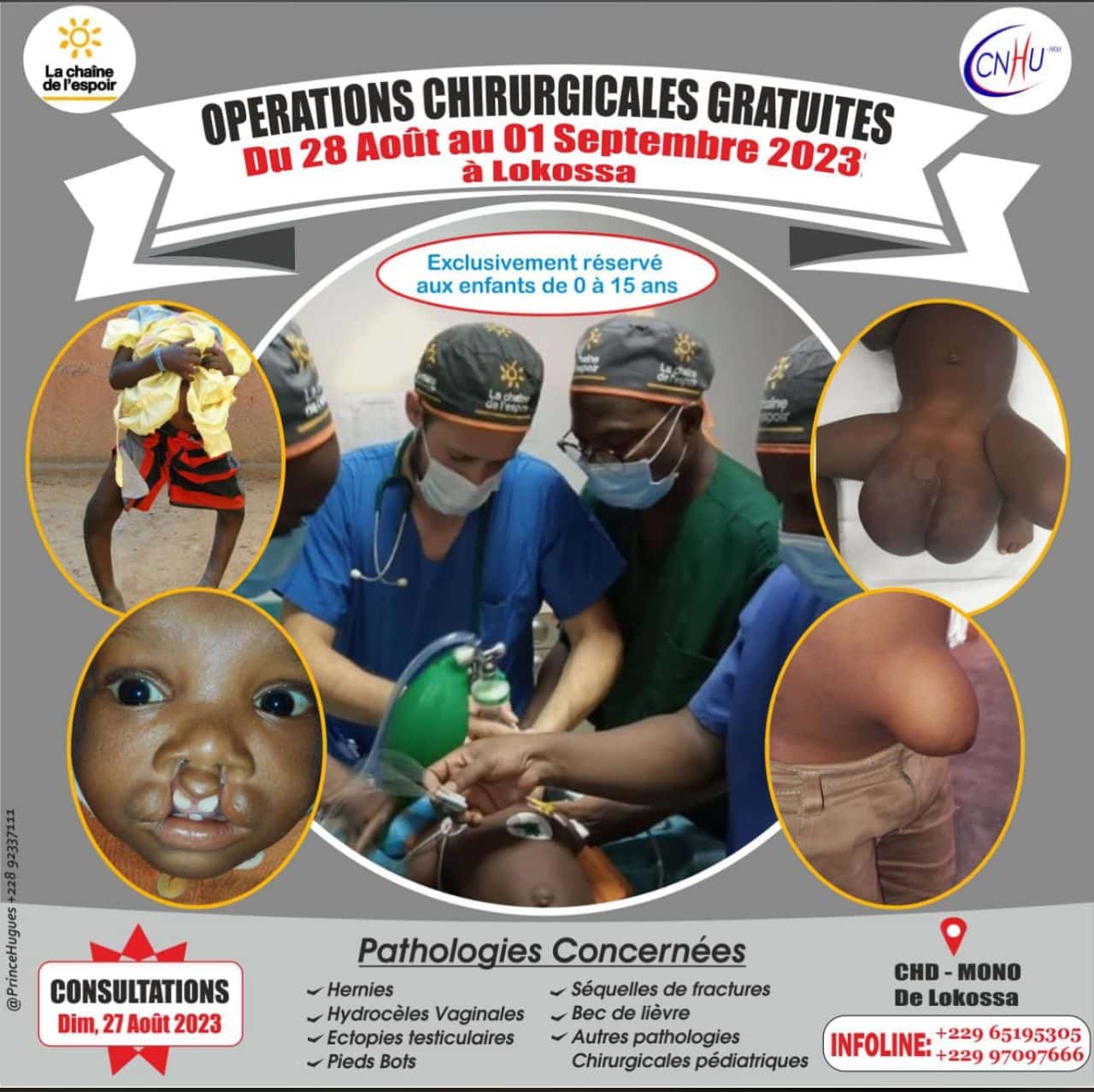 Opérations Chirurgicales Gratuites : Une Chance Inédite au CHD Mono de Lokossa au Bénin !