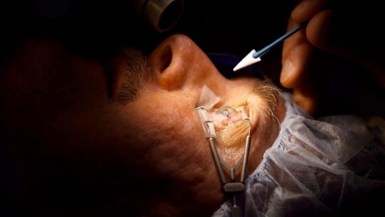 chirurgie-oeil-laser-1170×658