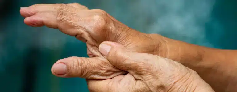 Image de l’article Arthrite : une maladie à ne pas confondre avec l’arthrose