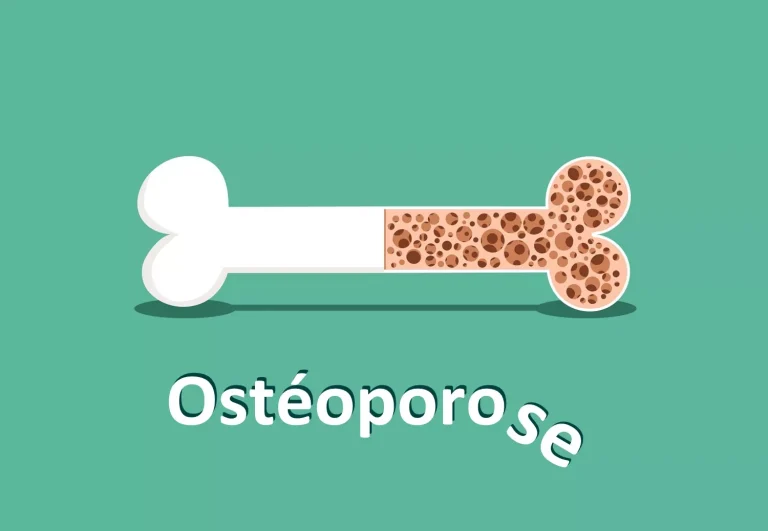 ostéoporose_os_AdobeStock_jiaking1
