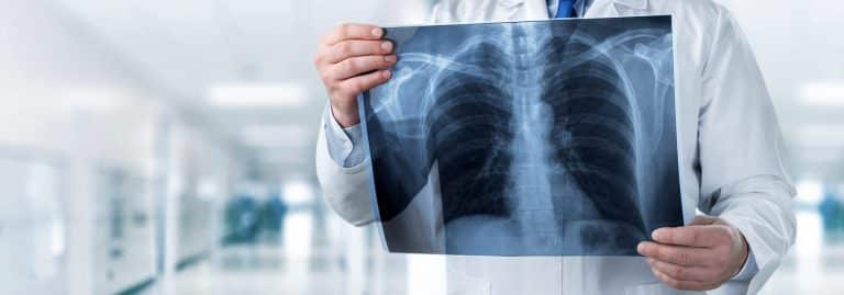 radiologie-poumon-medecin